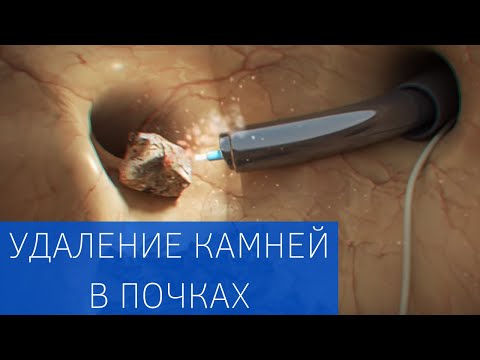 How to clean your kidneys at home
