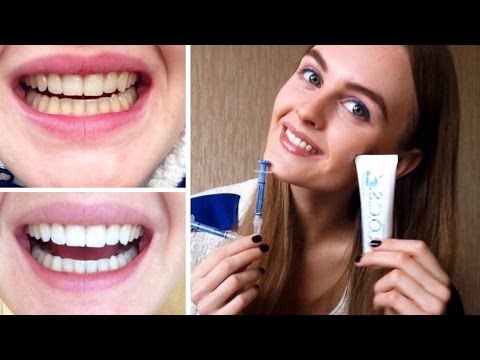 Comment blanchir les dents sans nuire à l'émail - 10 méthodes folkloriques et 11 méthodes médicales
